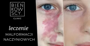 Malformacje naczyniowe: Przewodnik po objawach i metodach leczenia w Biekowscy Clinic