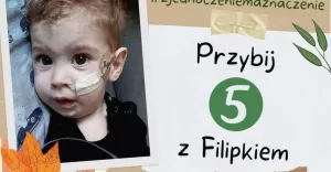 przybij 5