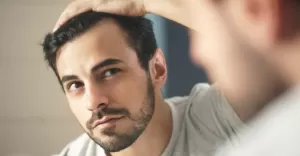 hairloss