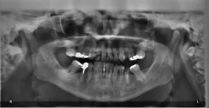 Pantomogram